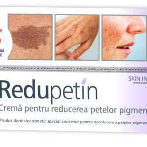 Crema pentru reducerea petelor pigmentare Redupetin
